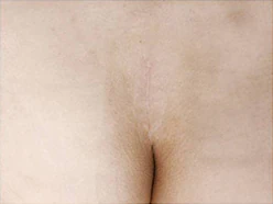 정중앙 채취